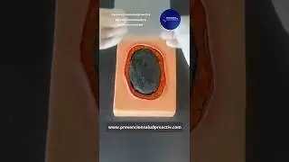 🩹Tipos de AP&Oacute;SITOS para HERIDAS❤️&zwj;🩹