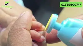 Smart Baby Nail Trimmer | শিশুর যত্নে আধুনিক সমাধান