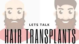 Hair Replacement Hair System Review Lets talk TRANSPLANTS!