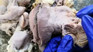 Femal genital system