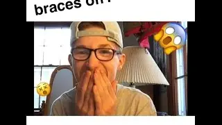 Getting/Got my braces off!