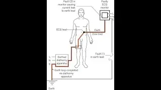 ELECTRICITY AND ANAESTHESIA, EXPLAINED BY MOHAMED ANWER RIFKY &ndash; ANAESTHESIA PHYSICS &ndash; محمد ا. رفقي