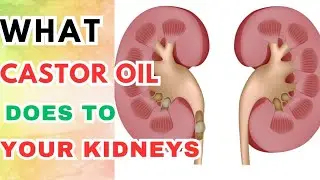 How Castor Oil Improves Kidneys Stones Naturally.