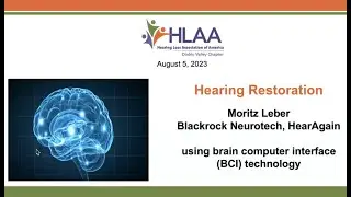 Development of a Novel Auditory Nerve Implant