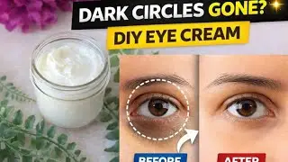  🌿Homemade Dark Circles Cream | Under Eye Brightening Remedy 💫
