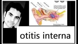 Types otitis interna