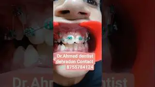 #dentalprofessionals #smiledesigndental @dr.md.ahmedaimcdentalcarea5987 @DrAhmedAimc