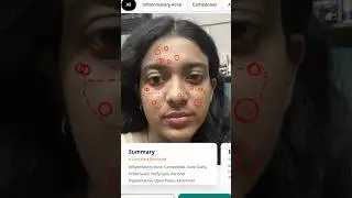 From dry skin to glowing skin | dermatologist solution | Cureskin #review #cureskin #cureskinapp