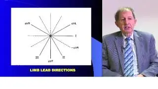 Prof Peter Macfarlane explains Glassgow Algorithm