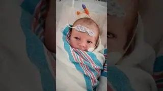 Heart surgery for this newborn set the stage for a healthy life!