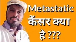 Metastatic Cancer kya hai | What is Metastatic cancer in hindi | Metastatic Cancer meaning | #shorts