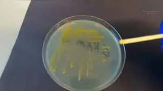 KOH Test