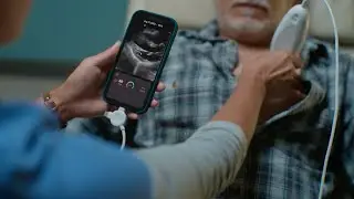 Meet Exo Iris, a new age of ultrasound