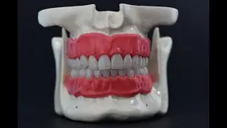 DentalModel,maxila,mandibula,teeth,gingiva