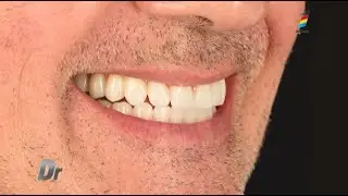Diferența dintre protezele dentare fixe și mobile, avantaje și dezavantaje