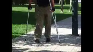 Leg braces Pedro