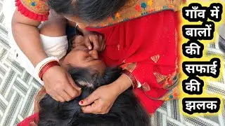 गांव में बालों की सफाई की झलक 👀 | Real Nitpicking ASMR | Pure Village Care