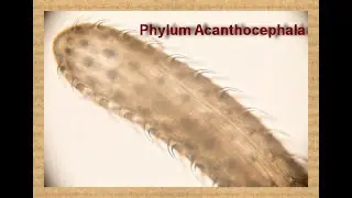 Phylum Acanthocephala 