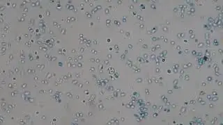 Chalymdospore of Candida albicans