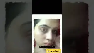 uorfi javed's botox gone wrong😱💉 #shortsfeed