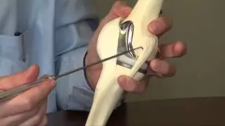 Knee Arthritis - Advanced Bone & Joint - Dr. Dane Glueck