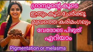 Cloves are enough to uproot blackheads and throw them away. #Pigmentation,melasma #Skin care