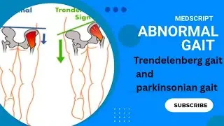 Trendelenburg vs Parkinsonian Gait | Concept + Exam Writing