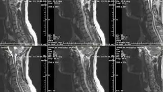 X-Rays, CT Scans, & MRIs - What Are They?
