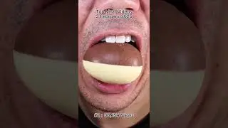 The Most Satisfying Chocolate and Candy ASMR Compilation 🍫🍬 #DoctorTristanPeh #Chocolate #Candy