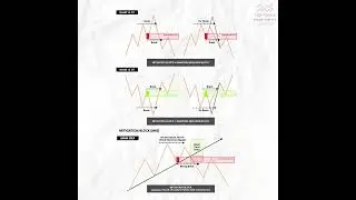 Head & Shoulder Pattern 🔥 Most Trusted Reversal Setup