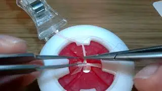 20251217  end to side anastomosis (parachute method)