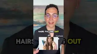 Will Your Hair Fall Out on Minoxidil? Doctor Explains the Truth!