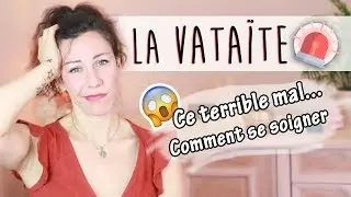 💀 ES-TU ATTEINT(E) DE VATAÏTE ??? Comment s'en sortir... !