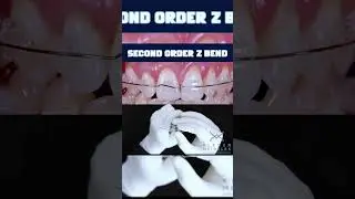 SECOND ORDER Z BEND - ORTHODONTIC TIPS #Shorts
