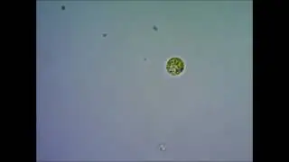 Вольвокс под микроскопом.