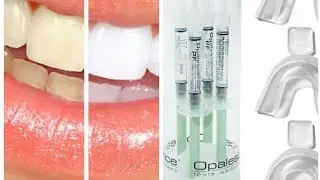 تبيض الاسنان  المنزلي رائعة opalescence الامريكي