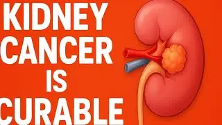 Kidney Cancer Explained Simply | Causes, Symptoms & Treatment