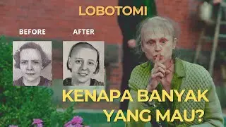 Ketika Dokter Percaya Depresi Bisa Sembuh dengan Palu | Lobotomi: Terapi atau Penyiksaan? 