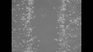 SAS cell, wound healing migration (1500X)