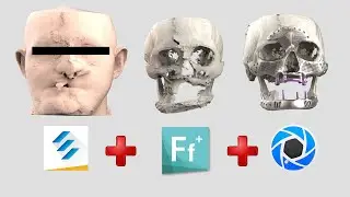 Customization of Implants: From Design to Surgery!#MedicalImplants #3dprinting