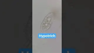 A fantastic look at a Hypotrich ciliate in action #biology #microscope