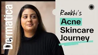 My Dermatica Acne Skincare Journey - Raakhi