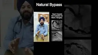 Heart Blockages unfit for stent and Bypass Have natural Bypass | #NaturalBypass #ECP #EECP #ACT