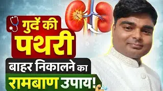 गुर्दे की पथरी का रामबाण इलाज | Kidney Stone Home Remedies in Hindi | Pathri Ka Desi Ilaj