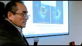 Angioplastia coronaria con balón medicado