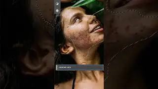 How To Remove Acne with Ai in Photoshop #shorts