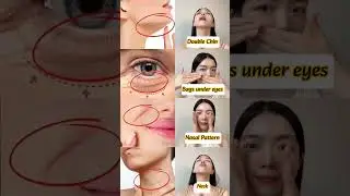 Facial Yoga Hacks For Double Chin, Nasal Pattern, Neck Lines #facelift #neckline #faceyoga #shorts