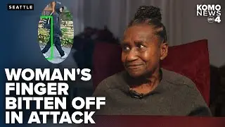 88-year-old Seattle woman recounts having finger bitten off during brutal robbery attack