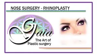 Nose job expert Miami FL &ndash; Top Rhinoplasty specialist Miami beach
