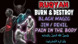 Ruqyah BAKAR/BURN  Satan, Jin yang tinggal di Otak, Badan dan seluruh Organ Tubuh